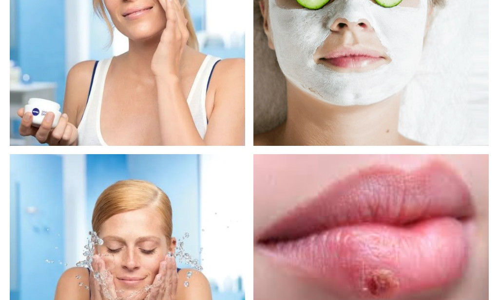 WHAT TO DO AGAINST PIMPLES? Pimples Removal
