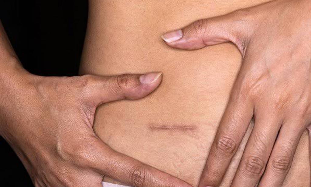 How to dictate the Symptoms of stomach Appendicitis