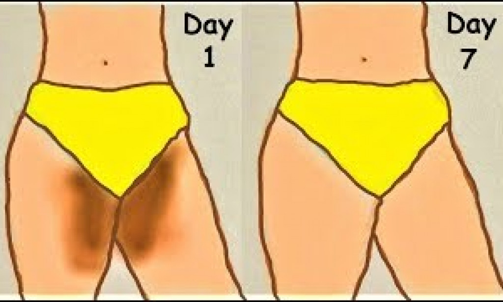 Three reasons why your private area is dark and what to do about it.