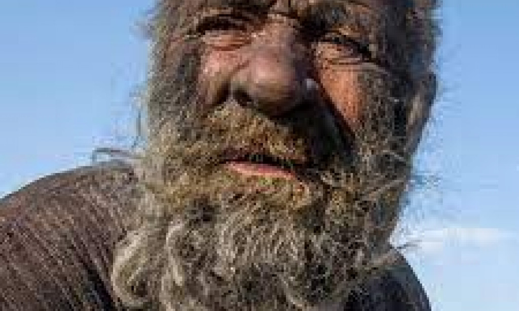 The World's Most Dirtiest Man Dies not long after his first shower