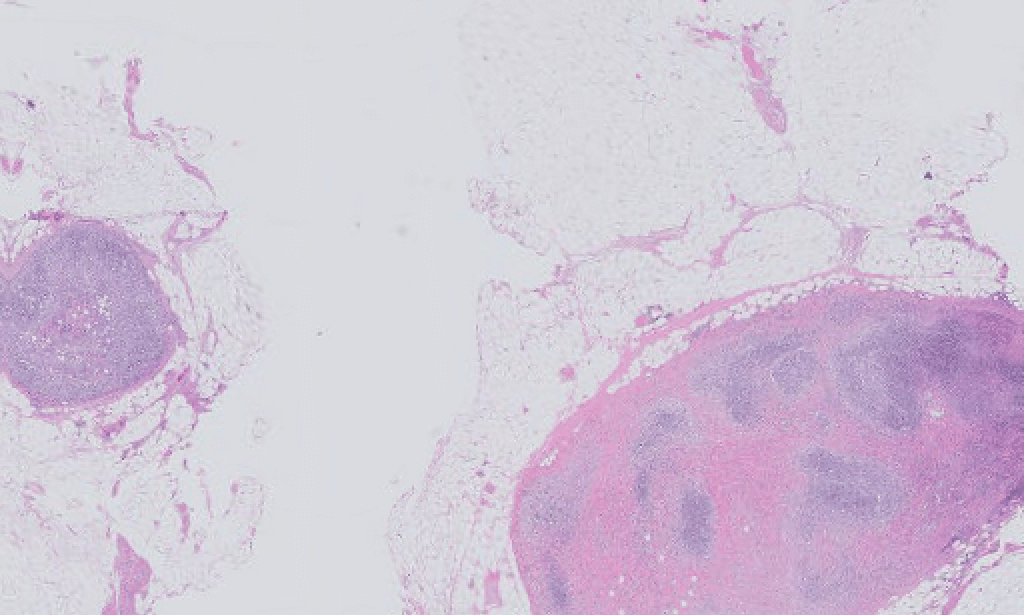 An international team examines the inner structure of a quasar jet.