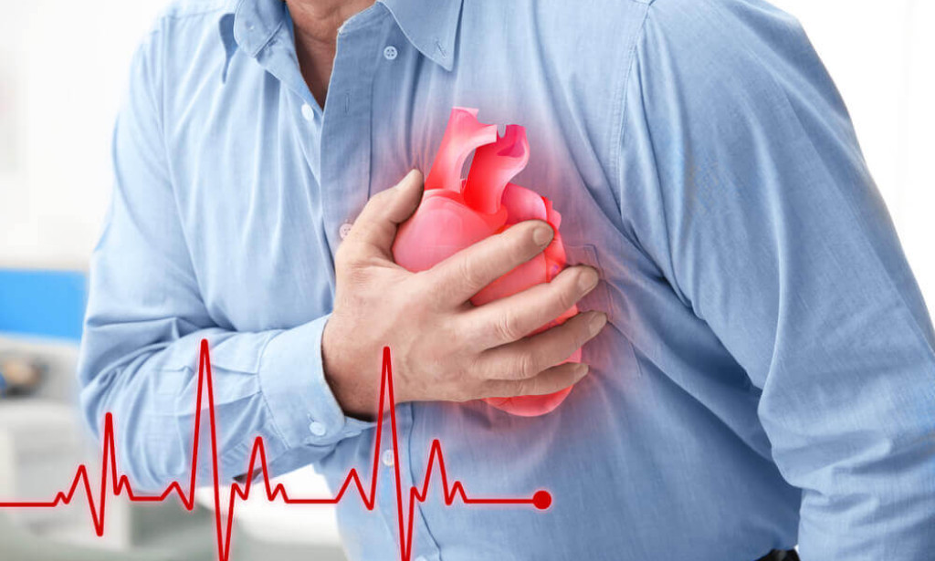 “Heart Attack and How to Prevent Yourself from Getting it”