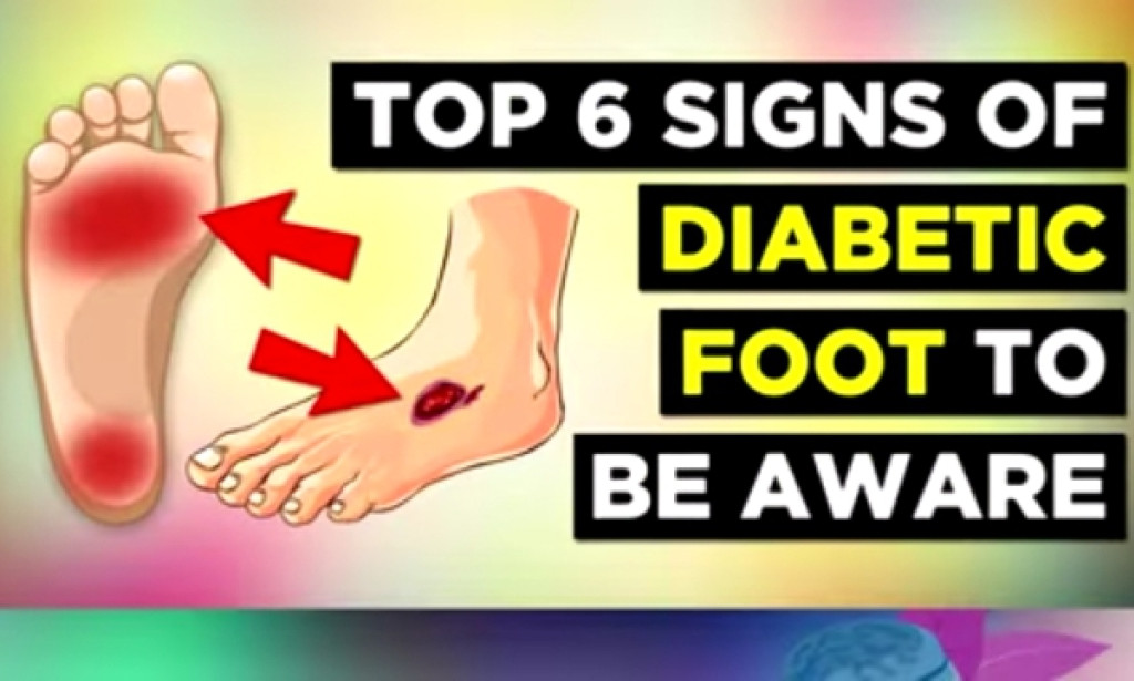 6 Early Signs of Diabetic Foot