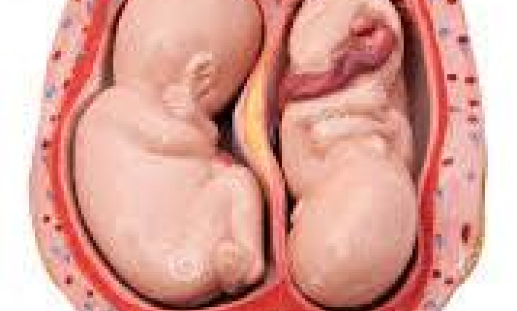 What You Should Do If You Want Twins