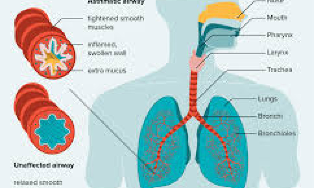 Holistic Asthma Care: Blending Traditional & Modern Medicine