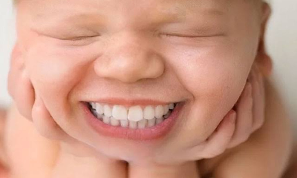 This Baby Was Born with Teeth: Doctors Explain What It Means