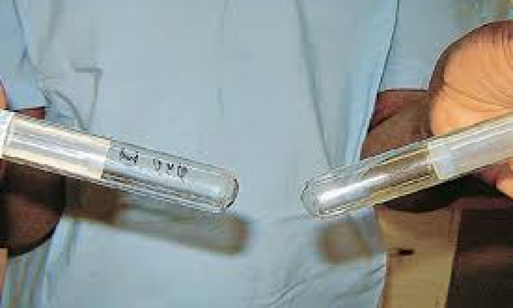 Why More Kenyan Men Are Turning to Sperm Donation