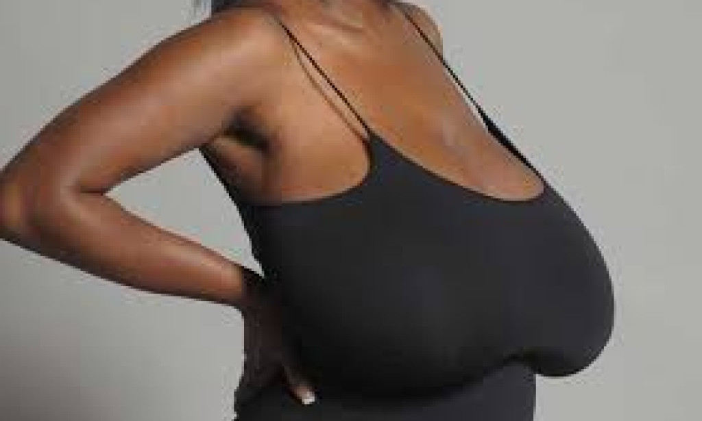 When Breasts Become a Burden